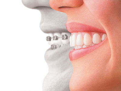 Pulaski Dental | Dental Fillings, Laser Dentistry and Oral Exams